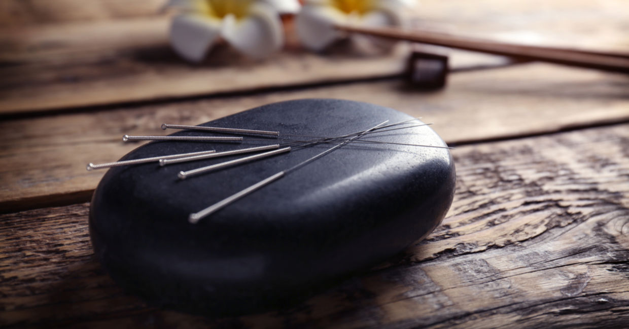 Acupuncture needles and stone. Acupuncture needles and stone.