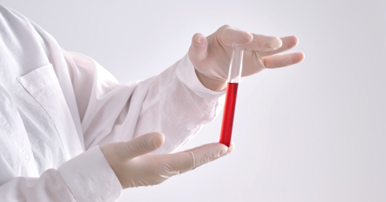 A new blood test detects Alzheimer's earlier. A new blood test detects Alzheimer's earlier.